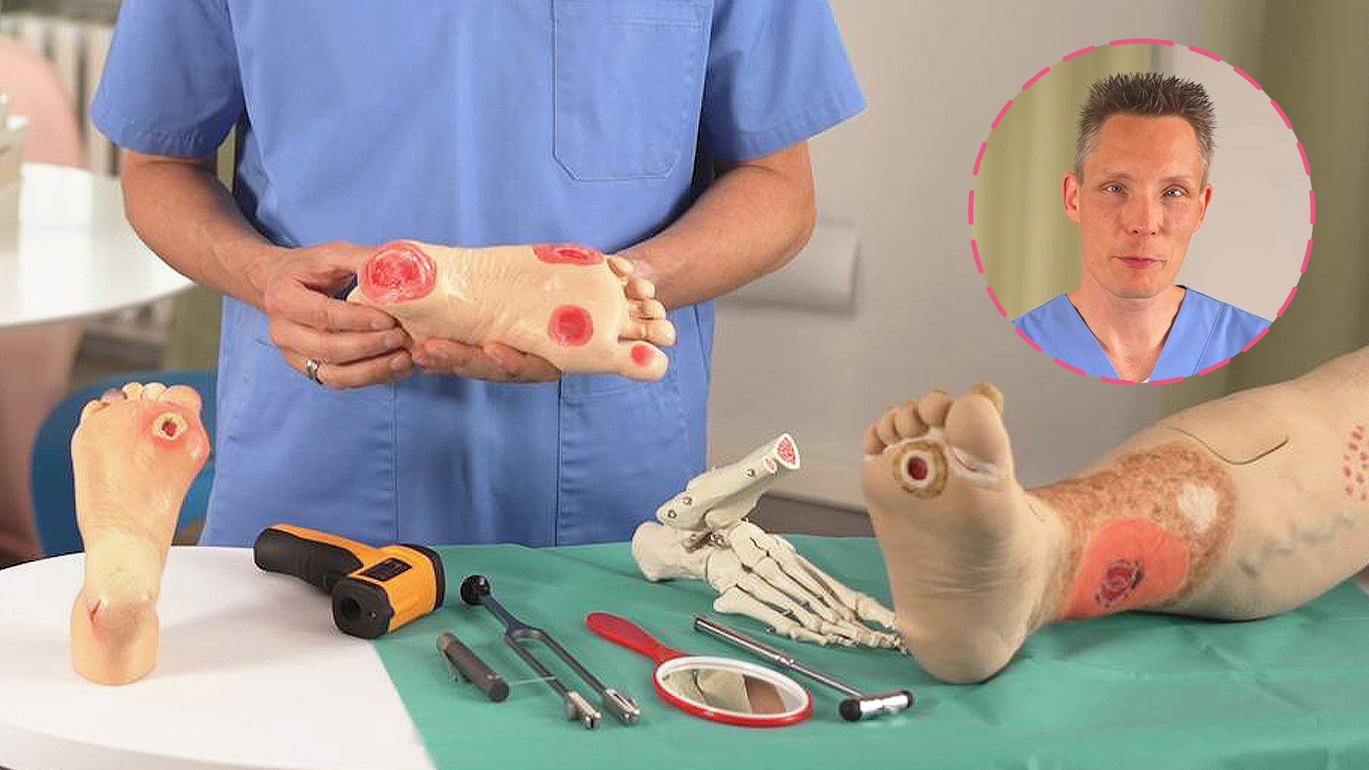 Das Diabetische Fußsyndrom