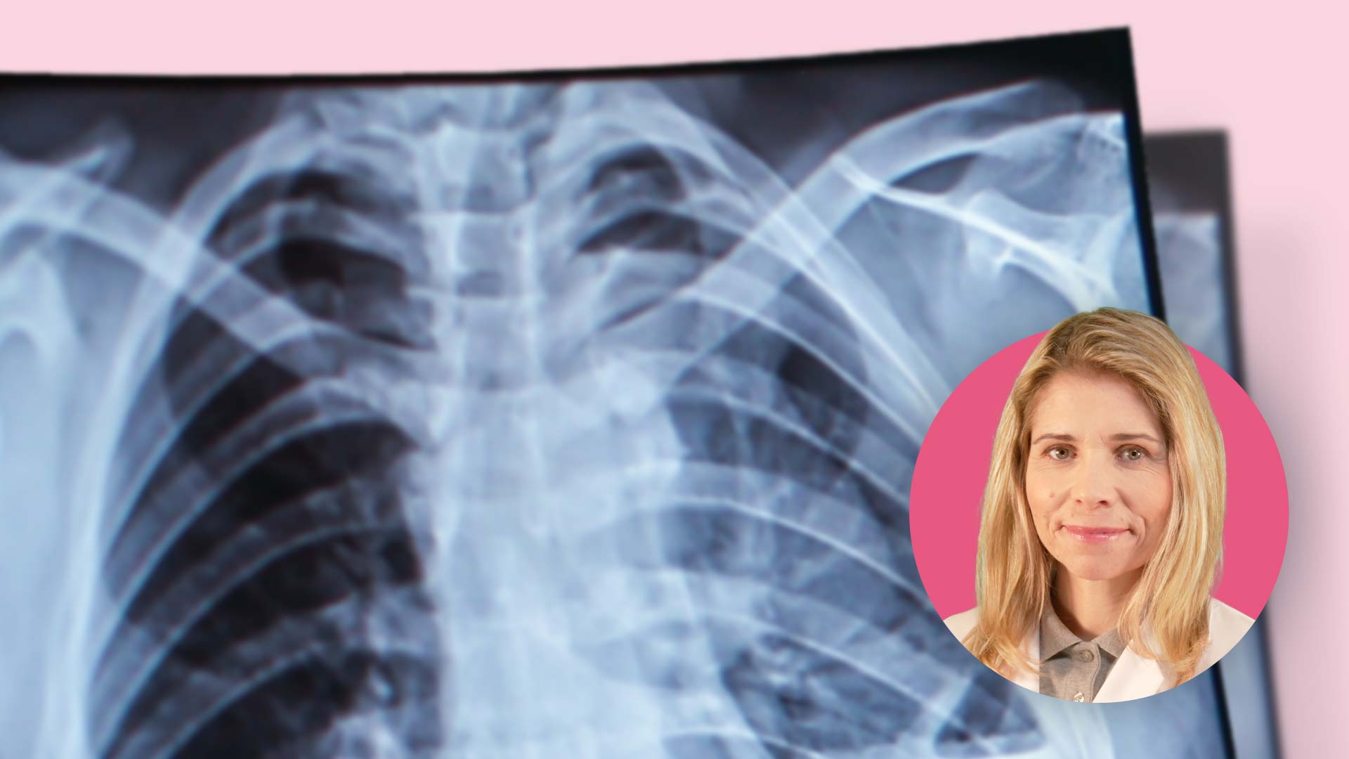 Chronisch obstruktive Lungenerkrankung (COPD): Effektive Inhalations- und Medikationsstrategien